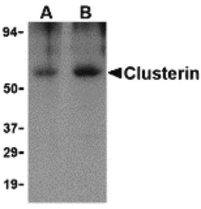 CLU / Clusterin Antibody - Western blot of Clusterin in human brain tissue lysate with Clusterin body at (A) 0.5 and (B) 1 ug/ml.