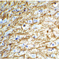 CLU / Clusterin Antibody - Immunohistochemistry of Clusterin in mouse brain tissue with Clusterin Antibody at 5 µg/mL.