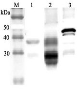 CLU / Clusterin Antibody - Western blot analysis using anti-Clusterin (mouse), pAb at 1:2000 dilution. 1: Mouse serum (2 ul). 4: Mouse seminal plasma. 5: Mouse Clusterin (nuclear form) (His-tagged).