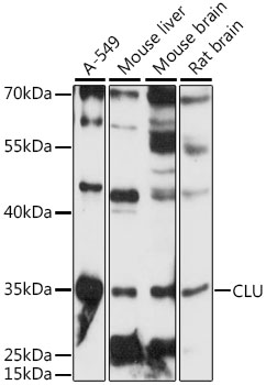 CLU / Clusterin Antibody - Western blot analysis of extracts of various cell lines, using CLU antibody at 1:3000 dilution. The secondary antibody used was an HRP Goat Anti-Rabbit IgG (H+L) at 1:10000 dilution. Lysates were loaded 25ug per lane and 3% nonfat dry milk in TBST was used for blocking. An ECL Kit was used for detection and the exposure time was 30s.