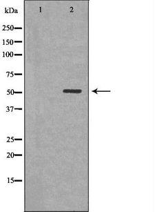 CLU / Clusterin Antibody - Western blot analysis of extracts of Y79 using CLU antibody. The lane on the left is treated with the antigen-specific peptide.