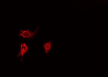 CLU / Clusterin Antibody - Staining HeLa cells by IF/ICC. The samples were fixed with PFA and permeabilized in 0.1% Triton X-100, then blocked in 10% serum for 45 min at 25°C. The primary antibody was diluted at 1:200 and incubated with the sample for 1 hour at 37°C. An Alexa Fluor 594 conjugated goat anti-rabbit IgG (H+L) antibody, diluted at 1/600, was used as secondary antibody.