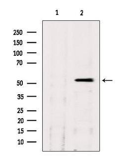 CLU / Clusterin Antibody - Western blot analysis of extracts of HepG2 cells using CLU antibody. Lane 1 was treated with the blocking peptide.