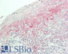 CLU1 / KIAA0664 Antibody - Human Tonsil: Formalin-Fixed, Paraffin-Embedded (FFPE)