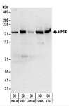CLU1 / KIAA0664 Antibody - Detection of Human and Mouse eIF3X by Western Blot. Samples: Whole cell lysate (50 ug) from HeLa, 293T, Jurkat, mouse TCMK-1, and mouse NIH3T3 cells. Antibodies: Affinity purified rabbit anti-eIF3X antibody used for WB at 0.1 ug/ml. Detection: Chemiluminescence with an exposure time of 75 seconds.