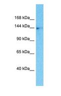 CLU1 / KIAA0664 Antibody - Western blot of CLUH Antibody with MDA-MB-435s Whole Cell lysate.  This image was taken for the unconjugated form of this product. Other forms have not been tested.