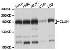 CLU1 / KIAA0664 Antibody - Western blot analysis of extracts of various cell lines, using CLUH antibody at 1:1000 dilution. The secondary antibody used was an HRP Goat Anti-Rabbit IgG (H+L) at 1:10000 dilution. Lysates were loaded 25ug per lane and 3% nonfat dry milk in TBST was used for blocking. An ECL Kit was used for detection and the exposure time was 5s.