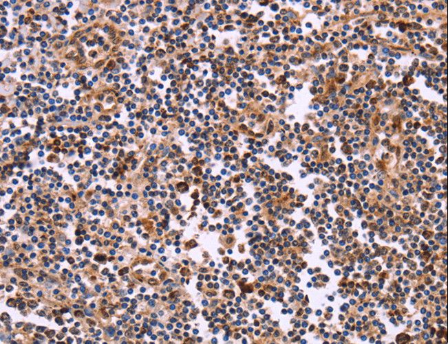 CLUAP1 Antibody - Immunohistochemistry of paraffin-embedded Human tonsil using CLUAP1 Polyclonal Antibody at dilution of 1:50.