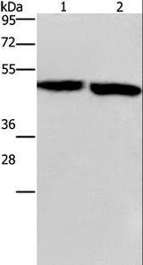 CLUAP1 Antibody - Western blot analysis of Mouse stomach and brain tissue, using CLUAP1 Polyclonal Antibody at dilution of 1:500.