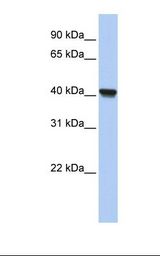 CLVS1 Antibody - Fetal lung lysate. Antibody concentration: 1.0 ug/ml. Gel concentration: 12%.  This image was taken for the unconjugated form of this product. Other forms have not been tested.
