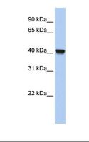 CLVS1 Antibody - Fetal lung lysate. Antibody concentration: 1.0 ug/ml. Gel concentration: 12%.  This image was taken for the unconjugated form of this product. Other forms have not been tested.