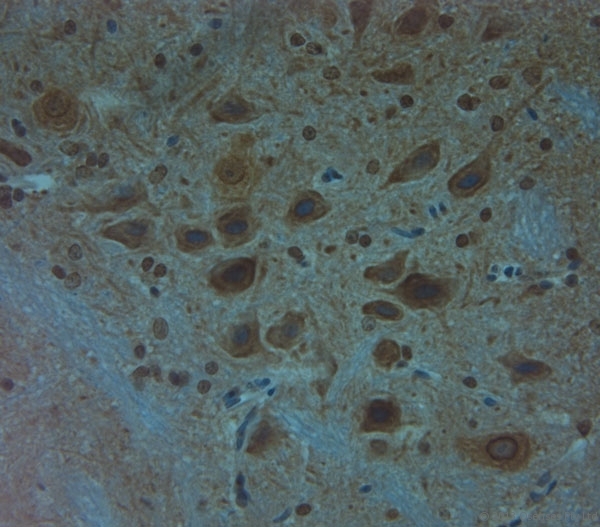 CLVS1 Antibody - Rabbit antibody to Clavesin 1 (300-354). IHC on paraffin sections of mouse spinal cord tissue using Rabbit antibody to Clavesin 1 (300-354). HIER: 1 mM EDTA, pH 8 for 20 min using Thermo PT Module. Blocking: 0.2% LFDM in TBST filtered through a 0.2 micron filter. Detection was done using Novolink HRP polymer from Leica following manufacturer\\\'s instructions. Primary antibody: dilution 1:1000, incubated 30 min at RT (using Autostainer). Sections were counterstained with Harris Hematoxylin.