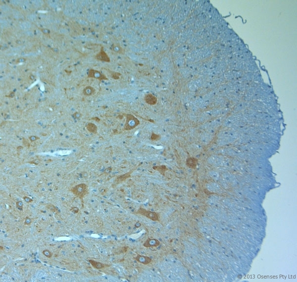 CLVS1 Antibody - Rabbit antibody to Clavesin 1 (300-354). IHC on paraffin sections of rat spinal cord tissue using Rabbit antibody to Clavesin 1 (300-354). HIER: 1 mM EDTA, pH 8 for 20 min using Thermo PT Module. Blocking: 0.2% LFDM in TBST filtered through a 0.2 micron filter. Detection was done using Novolink HRP polymer from Leica following manufacturer\\\'s instructions. Primary antibody: dilution 1:1000, incubated 30 min at RT (using Autostainer). Sections were counterstained with Harris Hematoxylin.