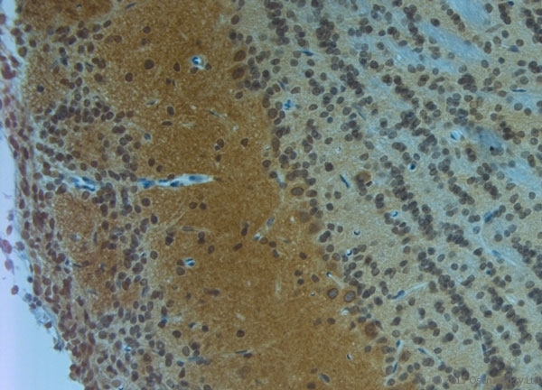 CLVS1 Antibody - Rabbit antibody to Clavesin 1 (300-354). IHC on paraffin sections of rat olfactory bulb tissue using Rabbit antibody to Clavesin 1 (300-354). HIER: 1 mM EDTA, pH 8 for 20 min using Thermo PT Module. Blocking: 0.2% LFDM in TBST filtered through a 0.2 micron filter. Detection was done using Novolink HRP polymer from Leica following manufacturer\\\'s instructions. Primary antibody: dilution 1:1000, incubated 30 min at RT (using Autostainer). Sections were counterstained with Harris Hematoxylin.