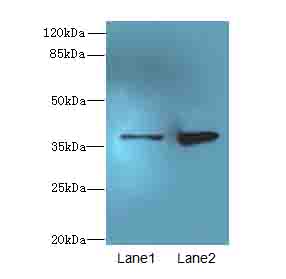 CLYBL Antibody - Western blot. All lanes: CLYBL antibody at 1 ug/ml. Lane 1: HeLa whole cell lysate. Lane 2: NIH/3T3 whole cell lysate. Secondary Goat polyclonal to Rabbit IgG at 1:10000 dilution. Predicted band size: 37 kDa. Observed band size: 37 kDa.