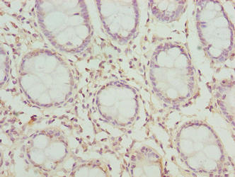 CLYBL Antibody - Immunohistochemistry of paraffin-embedded human colon tissue using CLYBL Antibody at dilution of 1:100
