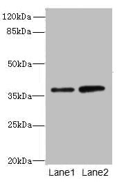 CLYBL Antibody - Western blot All lanes: CLYBL antibody at 1µg/ml Lane 1: Hela whole cell lysate Lane 2: NIH/3T3 whole cell lysate Secondary Goat polyclonal to rabbit IgG at 1/10000 dilution Predicted band size: 38, 34 kDa Observed band size: 38 kDa