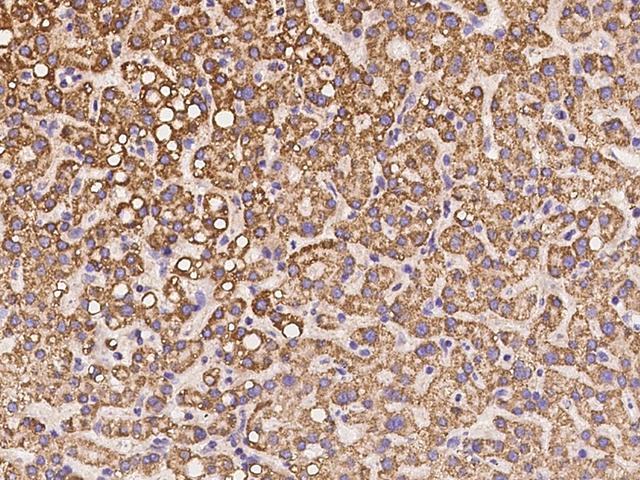 CLYBL Antibody - Immunochemical staining of human CLYBL in human liver with rabbit polyclonal antibody at 1:100 dilution, formalin-fixed paraffin embedded sections.
