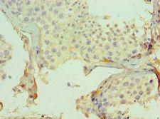 CMA1 / Mast Cell Chymase Antibody - Immunohistochemistry of paraffin-embedded human testicle using antibody at 1:100 dilution.