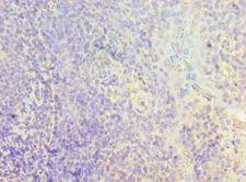 CMA1 / Mast Cell Chymase Antibody - Immunohistochemistry of paraffin-embedded human tonsil using antibody at 1:100 dilution.