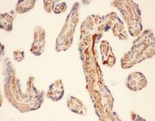 CMA1 / Mast Cell Chymase Antibody - IHC-P: Chymase antibody testing of human placenta tissue