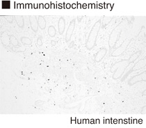 CMA1 / Mast Cell Chymase Antibody