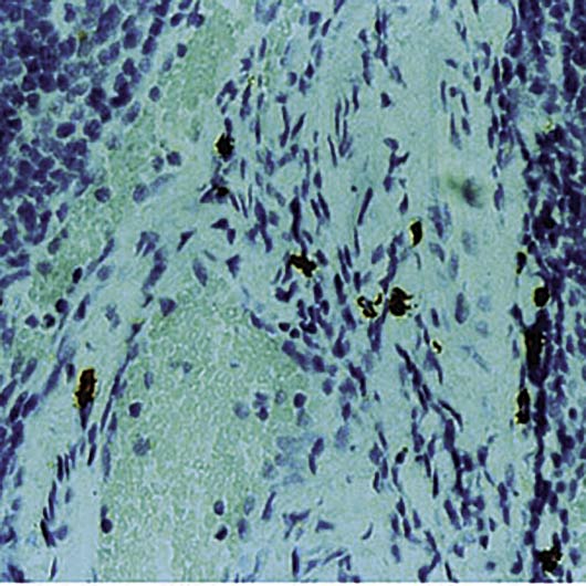 CMA1 / Mast Cell Chymase Antibody - Formalin-fixed, paraffin-embedded human tonsil stained with Mast Cell Chymase antibody.