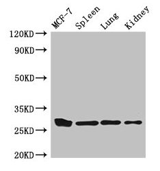 CMA1 / Mast Cell Chymase Antibody - Western Blot Positive WB detected in: MCF-7 whole cell lysate, Mouse spleen tissue, Mouse lung tissue, Mouse kidney tissue, Mouse brain tissue All lanes: CMA1 antibody at 3µg/ml Secondary Goat polyclonal to rabbit IgG at 1/50000 dilution Predicted band size: 28, 15 kDa Observed band size: 28 kDa