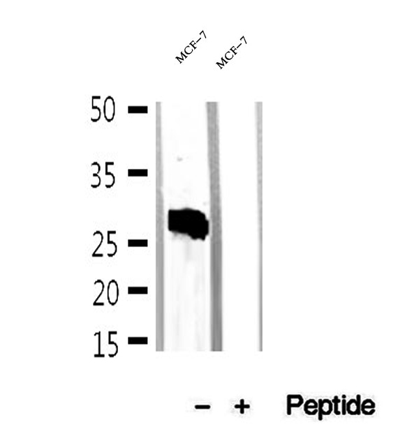 CMA1 / Mast Cell Chymase Antibody - Western blot analysis of extracts of MCF-7 cells using Mast cells Chymase antibody.
