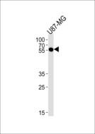 CMAS Antibody - CMAS Antibody western blot of U87-MG cell line lysates (35 ug/lane). The CMAS antibody detected the CMAS protein (arrow).