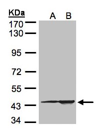 CMAS Antibody - Sample (30 ug of whole cell lysate). A:293T, B: HeLa S3. 7.5% SDS PAGE. CMAS antibody diluted at 1:1500