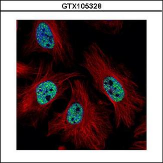 CMAS Antibody - Confocal immunofluorescence analysis (Olympus FV10i) of paraformaldehyde-fixed HeLa using CMAS antibody (Green) at 1:500 dilution. Alpha-tubulin filaments were labeled with alpha-tubulin antibody (Red) at 1:2000.