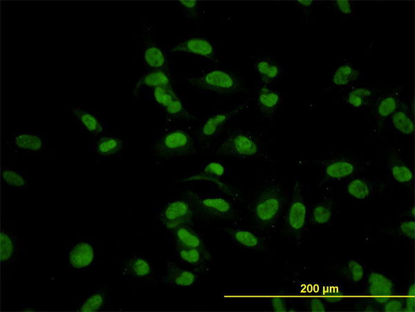 CMAS Antibody - Immunofluorescence of monoclonal antibody to CMAS on HeLa cell (antibody concentration 10 ug/ml).