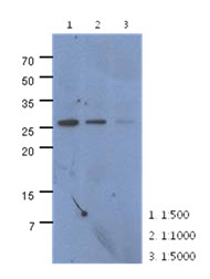 CMBL Antibody - Western Blot: The extracts of HeLa (40 ug) were resolved by SDS-PAGE, transferred to PVDF membrane and probed with anti-human CMBL antibody (1:500-1:5000). Proteins were visualized using a goat anti-mouse secondary antibody conjugated to HRP and an ECL detection system.