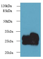 CMBL Antibody - Western blot. All lanes: CMBL antibody at 1 ug/ml. Lane 1: Mouse kidney tissue. Lane 2: Mouse liver tissue. Secondary Goat polyclonal to Rabbit IgG at 1:10000 dilution. Predicted band size: 28 kDa. Observed band size: 28 kDa.
