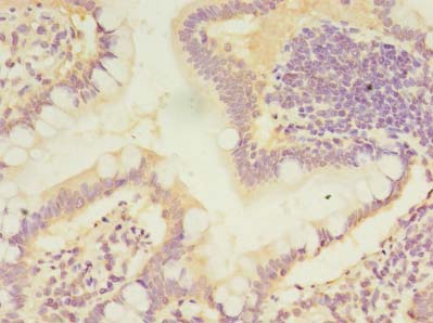 CMBL Antibody - Immunohistochemistry of paraffin-embedded human small intestine tissue using antibody at dilution of 1:100.