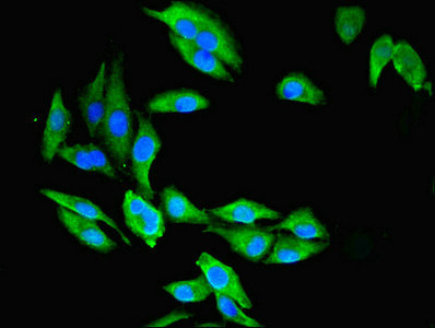 CMBL Antibody - Immunofluorescent analysis of Hela cells using CMBL Antibody at dilution of 1:100 and Alexa Fluor 488-congugated AffiniPure Goat Anti-Rabbit IgG(H+L)