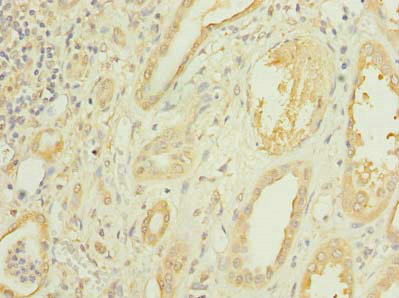 CMBL Antibody - Immunohistochemistry of paraffin-embedded human kidney tissue using CMBL Antibody at dilution of 1:100