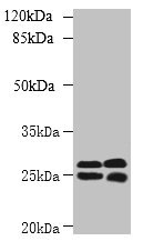 CMBL Antibody - Western blot All lanes: CMBL antibody at 1µg/ml Lane 1: Mouse kidney tissue Lane 2: Mouse liver tissue Secondary Goat polyclonal to rabbit IgG at 1/10000 dilution Predicted band size: 29 kDa Observed band size: 29, 25 kDa