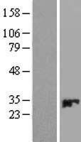 CMBL Protein - Western validation with an anti-DDK antibody * L: Control HEK293 lysate R: Over-expression lysate