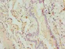 CMC1 Antibody - Immunohistochemistry of paraffin-embedded human lung tissue using antibody at dilution of 1:100.