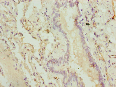 CMC1 Antibody - Immunohistochemistry of paraffin-embedded human lung tissue using CMC1 Antibody at dilution of 1:100