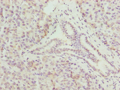 CMC1 Antibody - Immunohistochemistry of paraffin-embedded human pancreatic tissue using CMC1 Antibody at dilution of 1:100