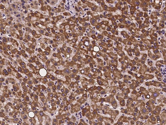 CMC1 Antibody - Immunochemical staining of human CMC1 in human liver with rabbit polyclonal antibody at 1:500 dilution, formalin-fixed paraffin embedded sections.