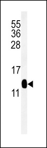 CMC2 / C16orf61 Antibody - Western blot of DC13 Antibody in mouse kidney tissue lysates (35 ug/lane). DC13 (arrow) was detected using the purified antibody.