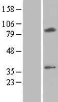CMC2 / C16orf61 Protein - Western validation with an anti-DDK antibody * L: Control HEK293 lysate R: Over-expression lysate