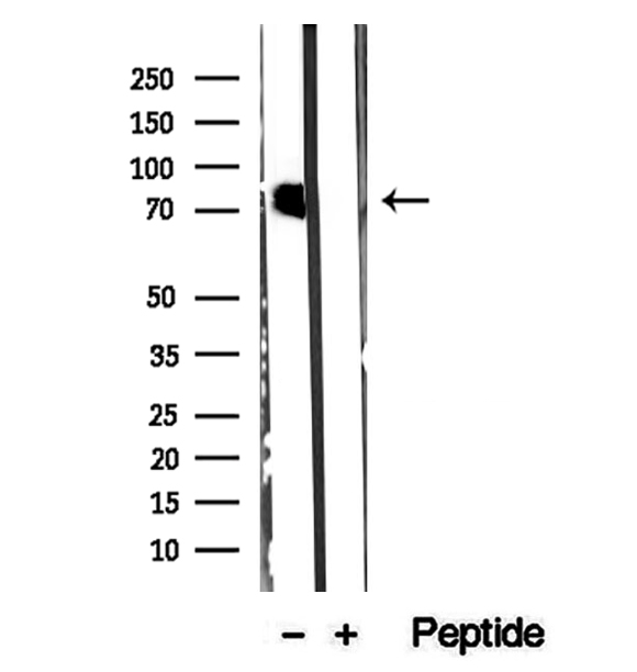 CMIP Antibody - Western blot analysis of extracts of K562 cells using CMIP antibody.