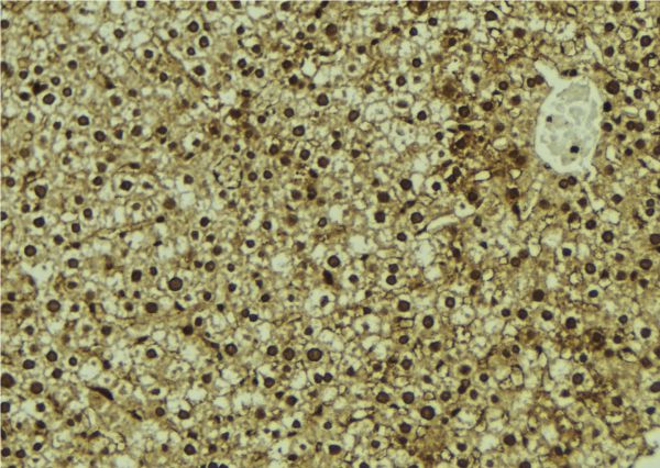 CMIP Antibody - 1:100 staining mouse liver tissue by IHC-P. The sample was formaldehyde fixed and a heat mediated antigen retrieval step in citrate buffer was performed. The sample was then blocked and incubated with the antibody for 1.5 hours at 22°C. An HRP conjugated goat anti-rabbit antibody was used as the secondary.