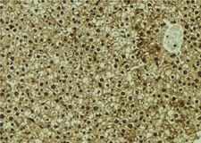 CMIP Antibody - 1:100 staining mouse liver tissue by IHC-P. The sample was formaldehyde fixed and a heat mediated antigen retrieval step in citrate buffer was performed. The sample was then blocked and incubated with the antibody for 1.5 hours at 22°C. An HRP conjugated goat anti-rabbit antibody was used as the secondary.