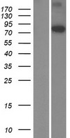 CMIP Protein - Western validation with an anti-DDK antibody * L: Control HEK293 lysate R: Over-expression lysate